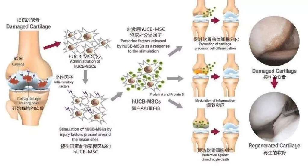 将扩增得到的软骨细胞输注到受损的膝关节处,会修复受损组织,让膝关节